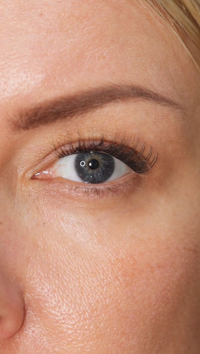 Eyes
